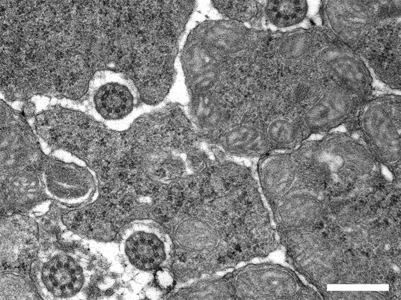 TEM cross section of photoreceptors throught the connecting cilium and inner segment