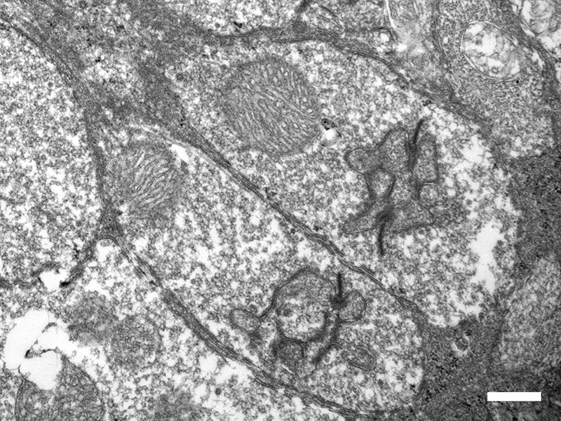 TEM image showing ribbon synapses in rod spherules