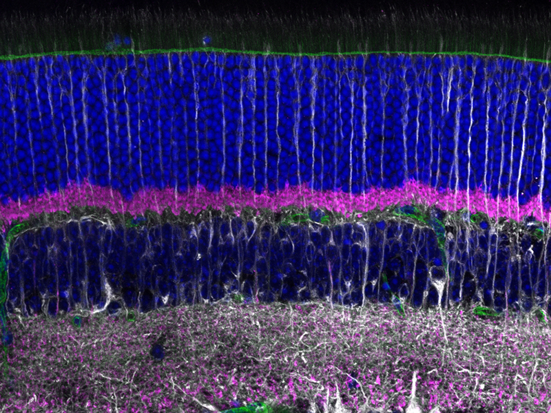 Mouse retinal cross section labeled with tubulin, VGLUT1, and DAPI