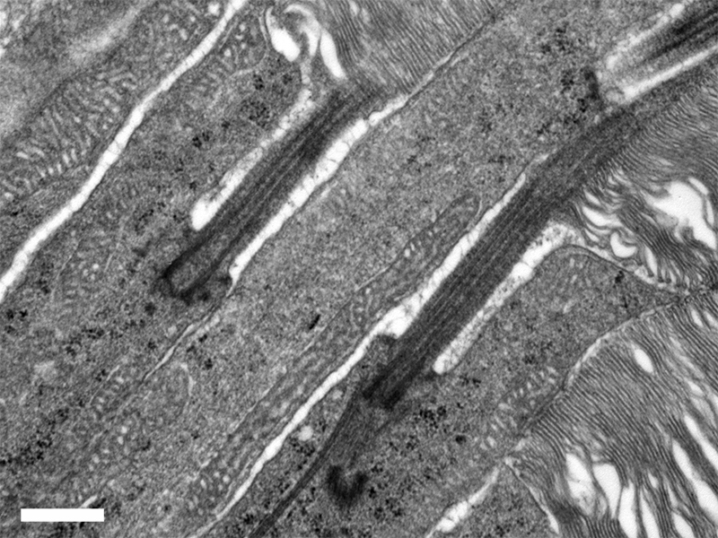 TEM section of photoreceptors showing the inner and outer segments separate by the connecting cilium